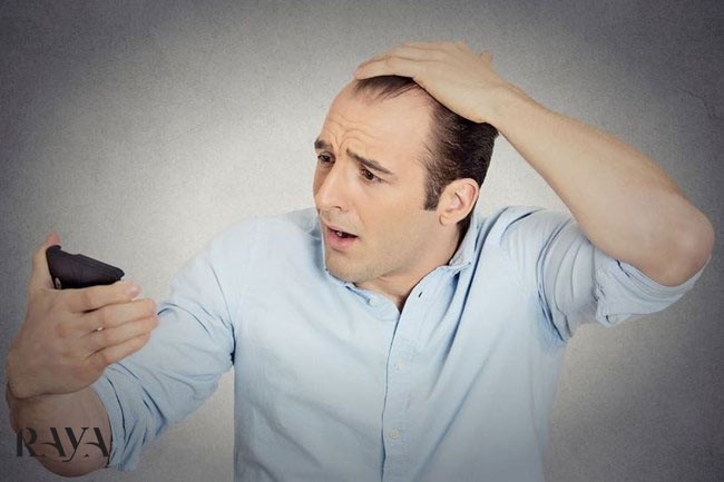 ریزش مو بعد از کرونا و راه های درمان آن  و روش تشخیص ریزش مو